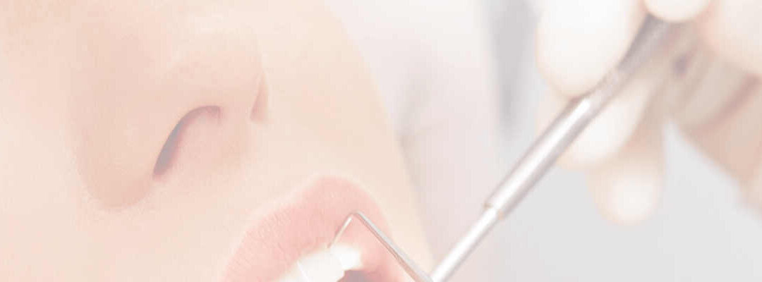 DEEP OVERBITE: WHAT TO LOOK FOR AND IDEAL AGE TO START TREATMENT